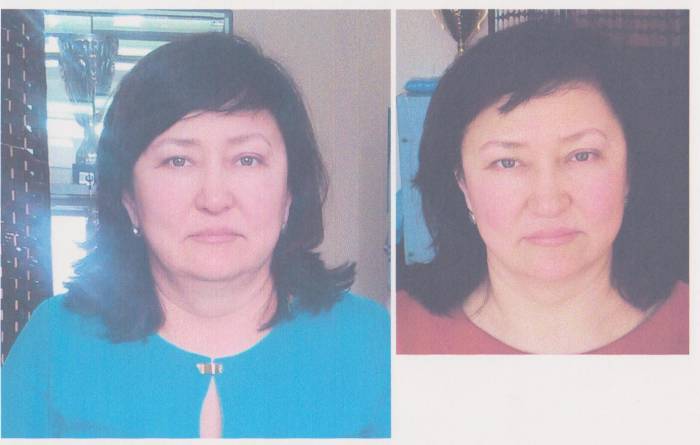 Лицо. Лифтинг. Эстетическое мануальное моделирование лица., фотография 4