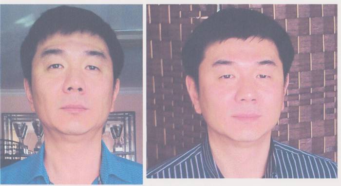 Лицо. Лифтинг. Эстетическое мануальное моделирование лица., фотография 5