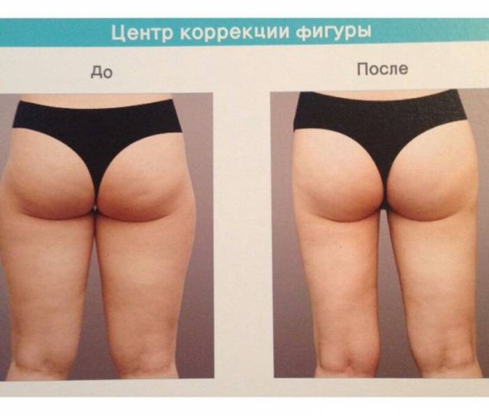 Организованные медицинские туры в Южную Корею. , фотография 3