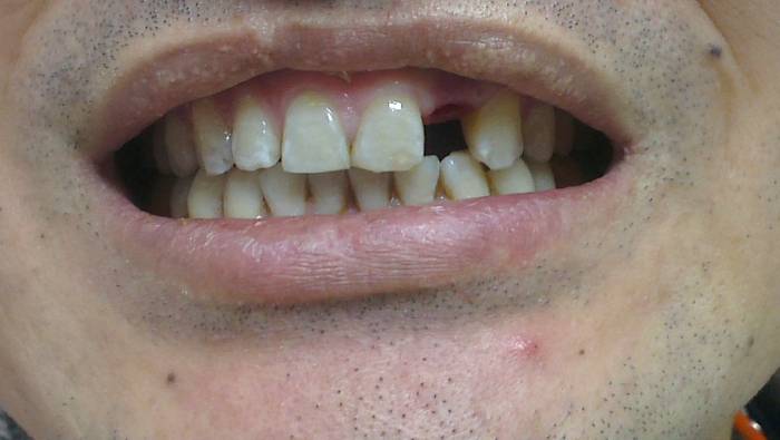 Внимание!, фотография 3