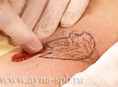 Шугаринг. Депиляция в Астане. Бикини-дизайн., фотография 4