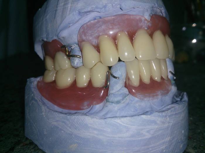 Зубной техник из России!, фотография 3