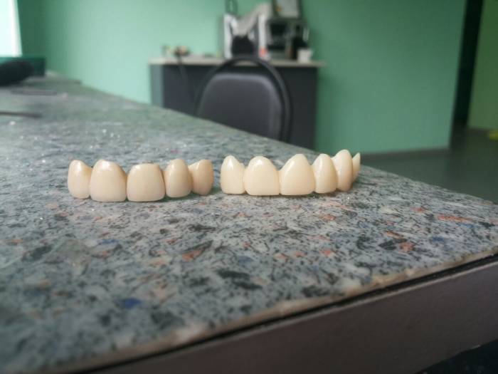 Зубной техник из России!, фотография 4