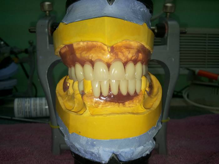Зубной техник из России!, фотография 5