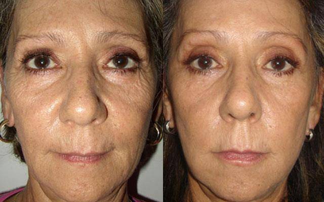 Крем против морщин Jeunesse Instantly Ageless , фотография 2