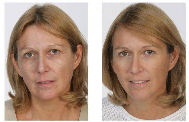 Крем против морщин Jeunesse Instantly Ageless , фотография 3