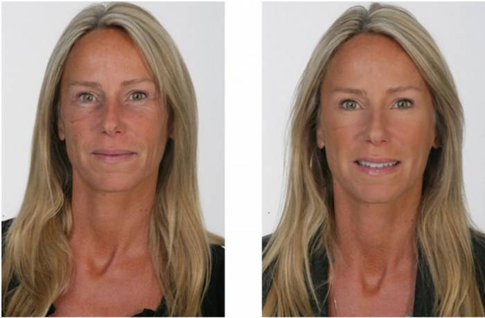 Крем против морщин Jeunesse Instantly Ageless , фотография 4