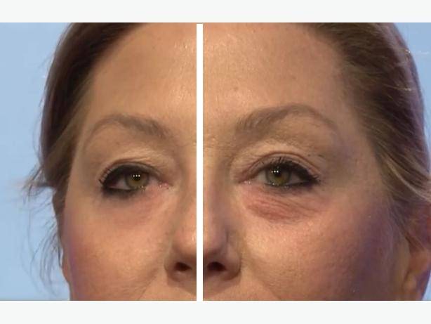 Крем против морщин Jeunesse Instantly Ageless , фотография 5