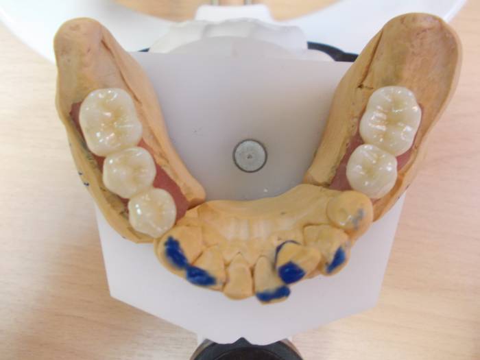 Зуботехническая лаборатория в Алматы., фотография 2