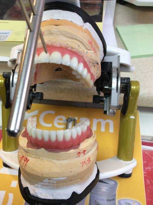 Зуботехническая лаборатория в Алматы., фотография 3