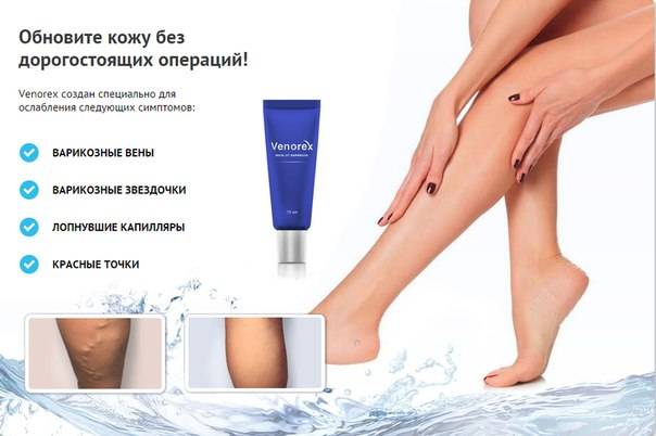 Мазь от варикоза Venorex, фотография 1
