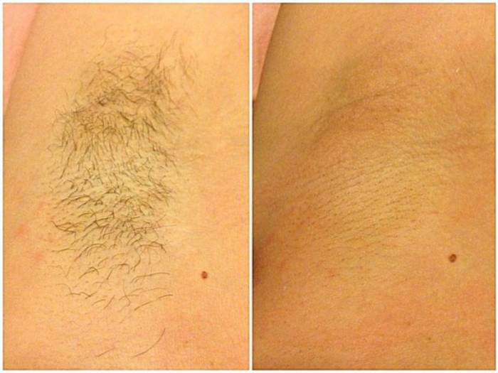 Гладкая кожа., фотография 5