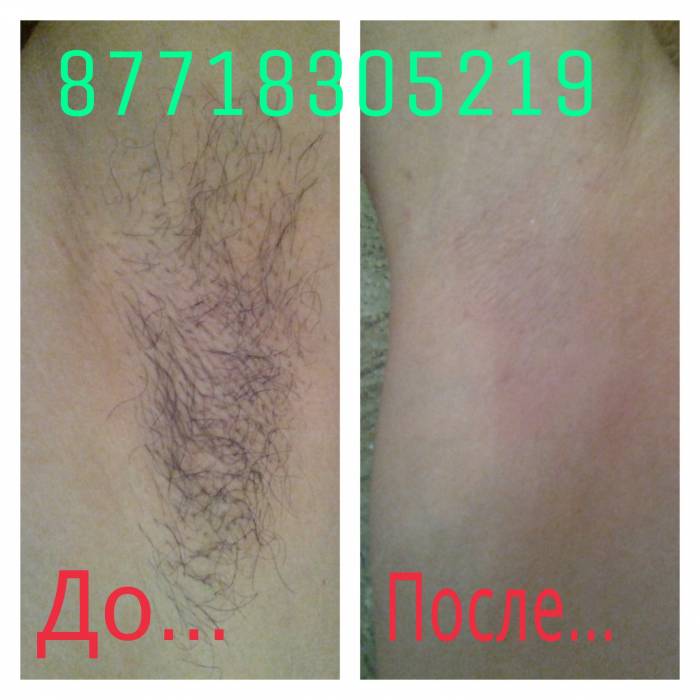 Шугаринг.Наращивание ресниц., фотография 4