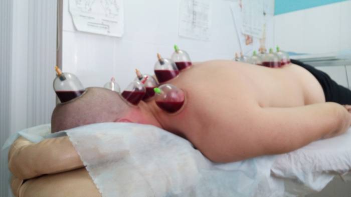 Кровопускание Хиджама , фотография 1