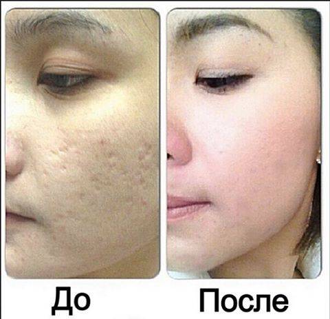микрокрем Jeunesse Instantly Ageless, VIP косметика, фотография 5