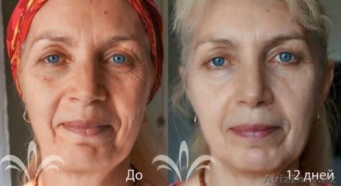 микрокрем Jeunesse Instantly Ageless, VIP косметика, фотография 6