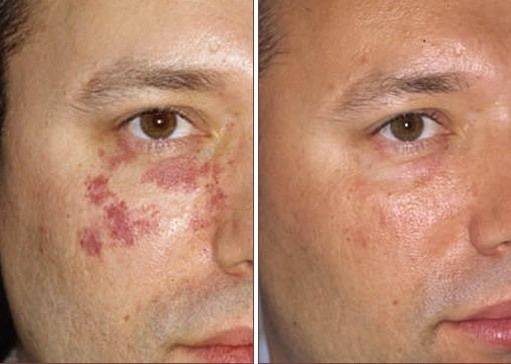 Jeunesse Дневной увлажняющий крем LUMINESCE, VIP косметика, фотография 8