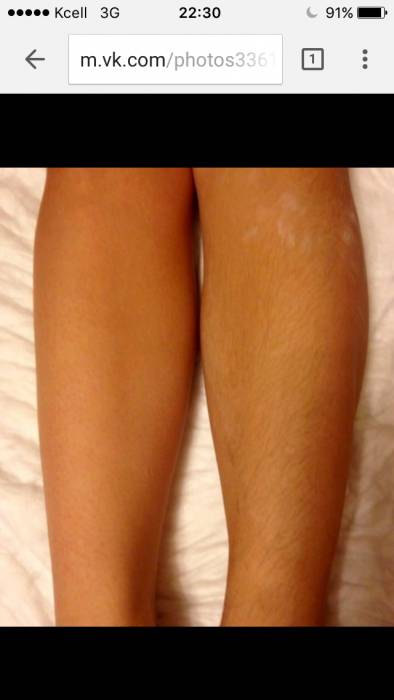 Шугаринг , фотография 3