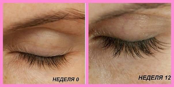 Средство для роста ресниц и бровей Lurey Lash Md, фотография 2