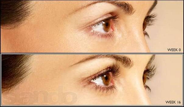 Средство для роста ресниц и бровей Lurey Lash Md, фотография 4