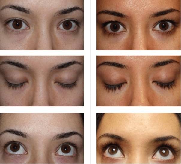 Средство для роста ресниц и бровей Lurey Lash Md, фотография 5