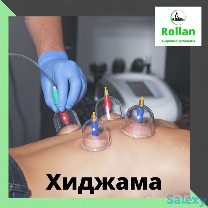 Хиджама / Мануальная терапия / Огненный массаж на выезд кәсіби түрде, фотография 1