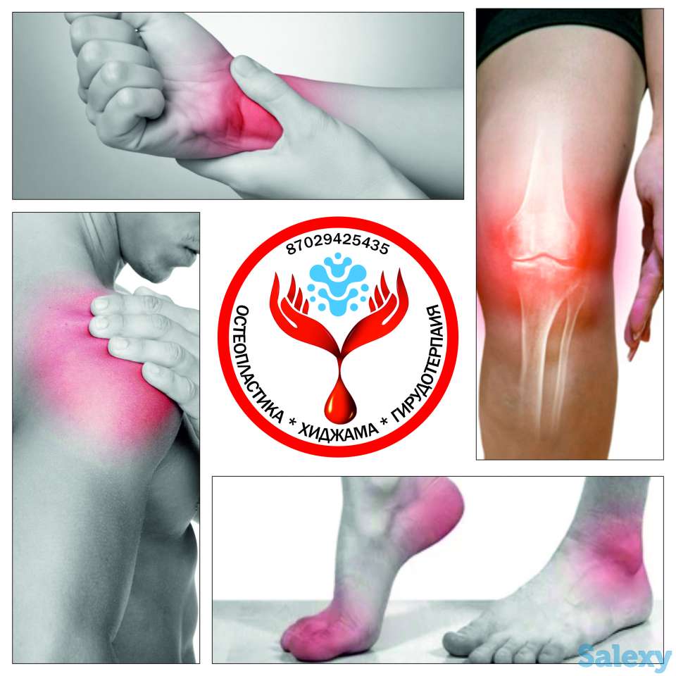 Остеопатия, фотография 2