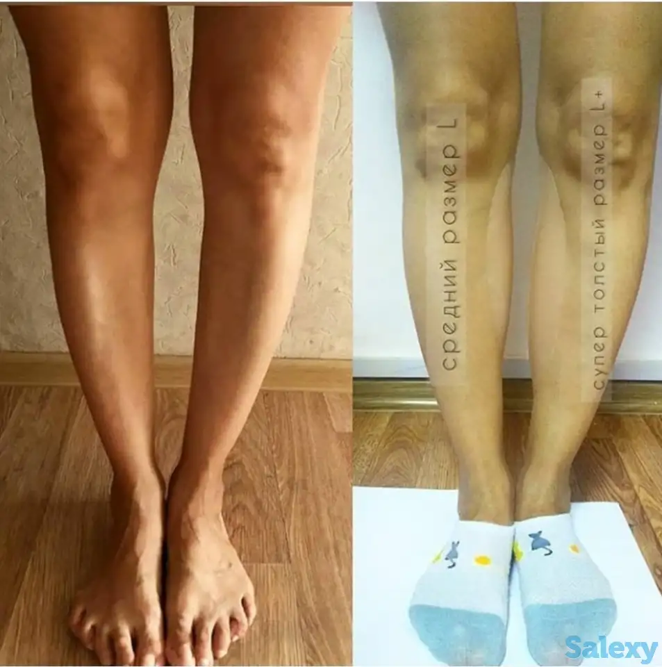 Силиконовые накладки для кривых ног, фотография 11