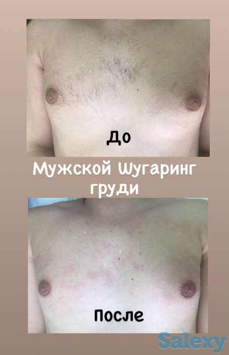 Шугаринг/Депиляция М/Ж, фотография 5