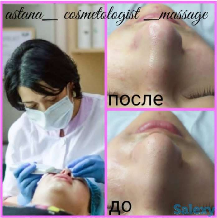 комбинированная чистка лица, фотография 1