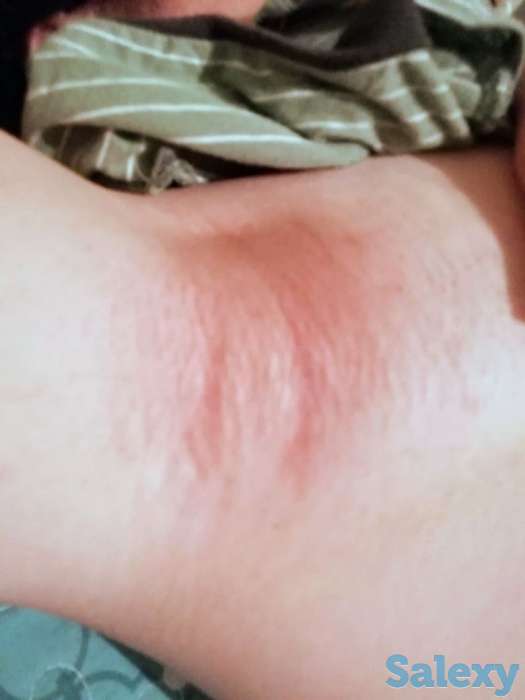 Шугаринг с выездом на дом., фотография 1