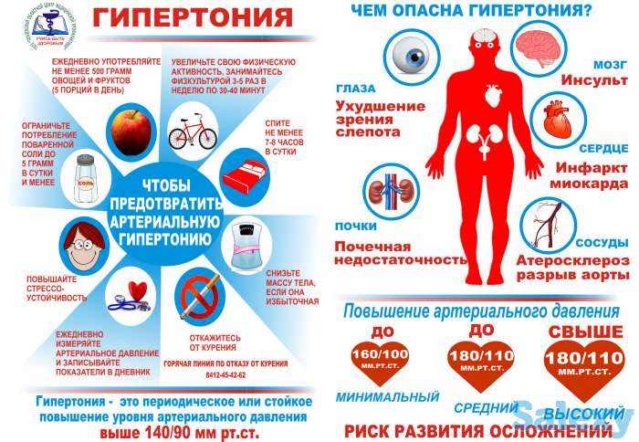 правка атланта, фотография 3