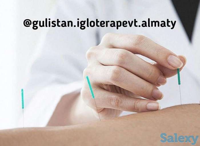 Аккурунктурная пластика лица, фотография 2