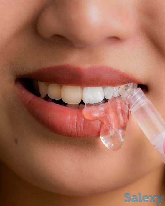 Отбеливание для зубов Happy Smile, фотография 7