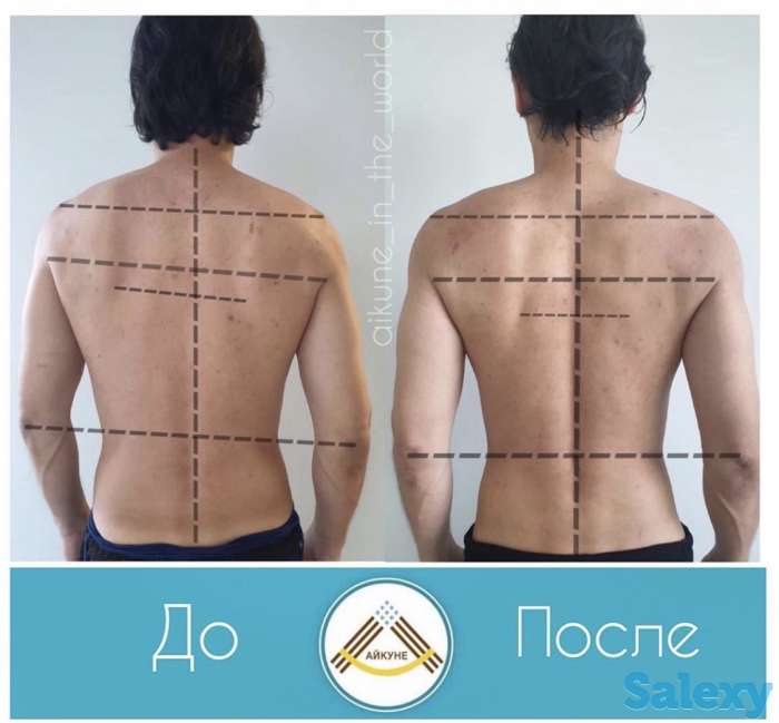 Оздоровительный центр «Айкуне», фотография 5