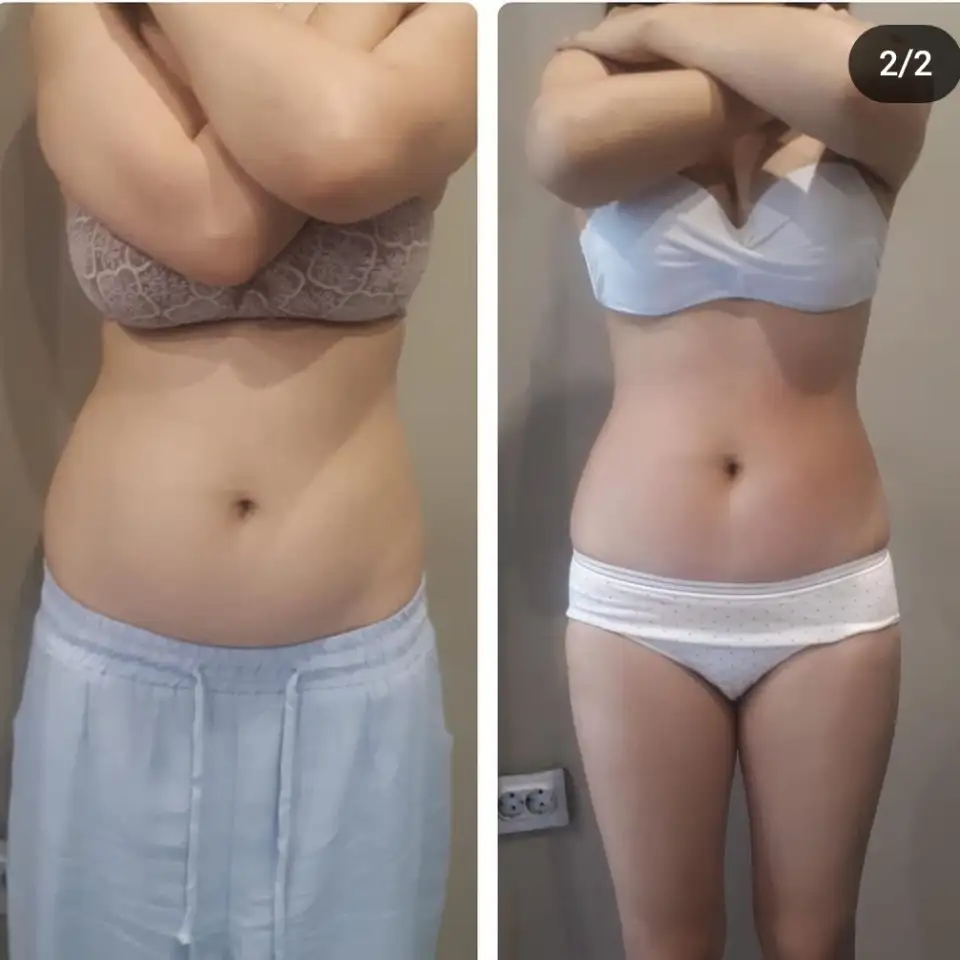 Антицеллюлитный массажКоррекция фигуры, фотография 1