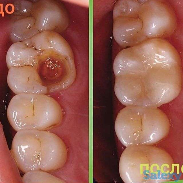 Стоматология, фотография 6