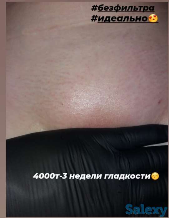 Шугаринг/Депиляция М/Ж, фотография 15