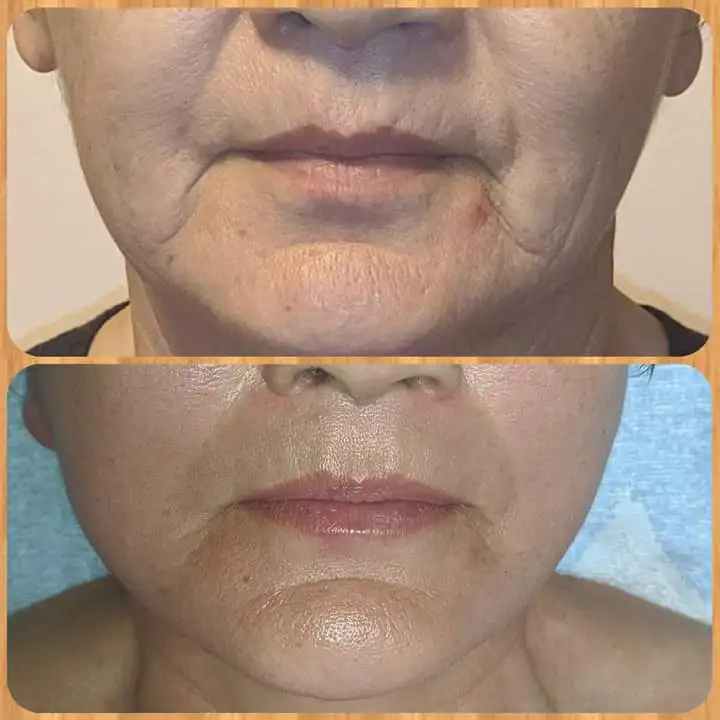 Профессиональный маccaж Aлматы, фотография 3