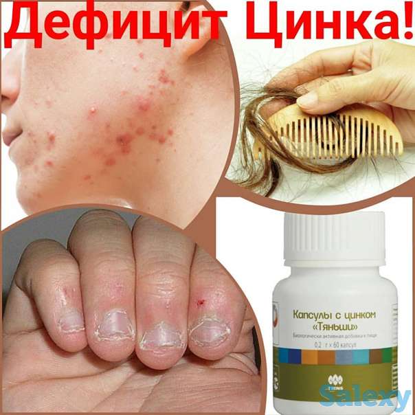 Цинк в капсулах при бесплодии, фотография 2