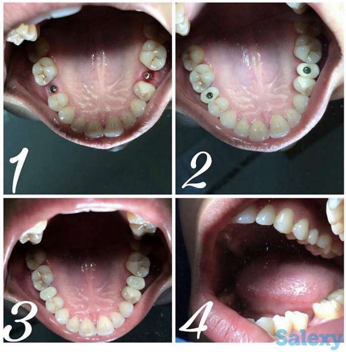 Все виды стоматологических услуг, фотография 1
