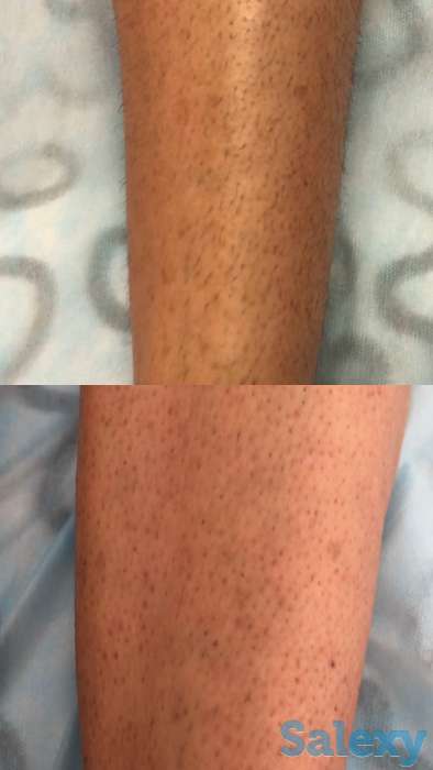 Депиляция | ламинирование, фотография 2