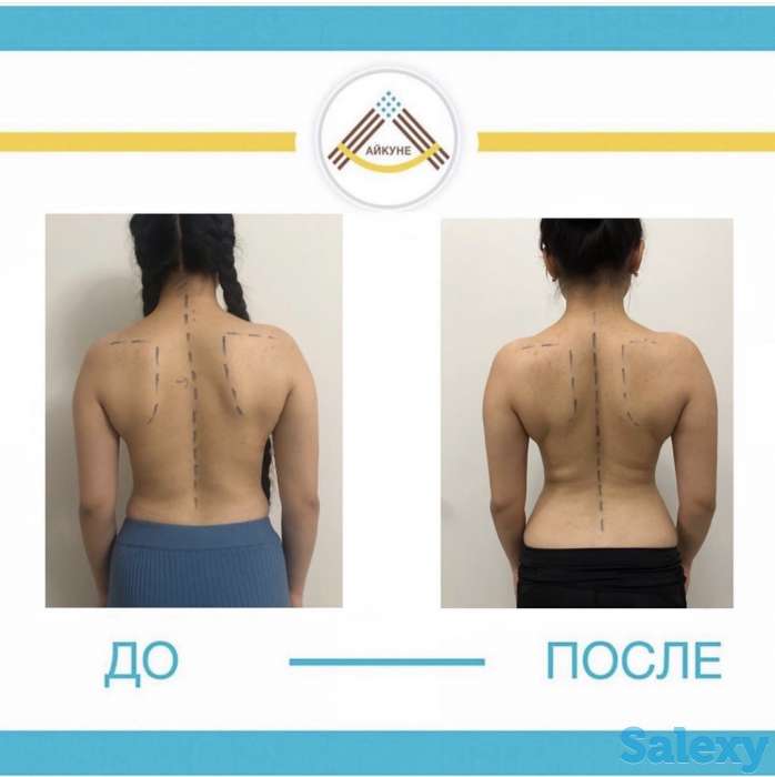 Оздоровительный центр «Айкуне», фотография 7