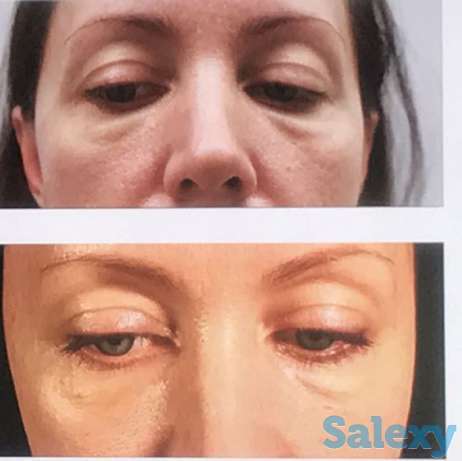 Косметолог в алматы, фотография 1