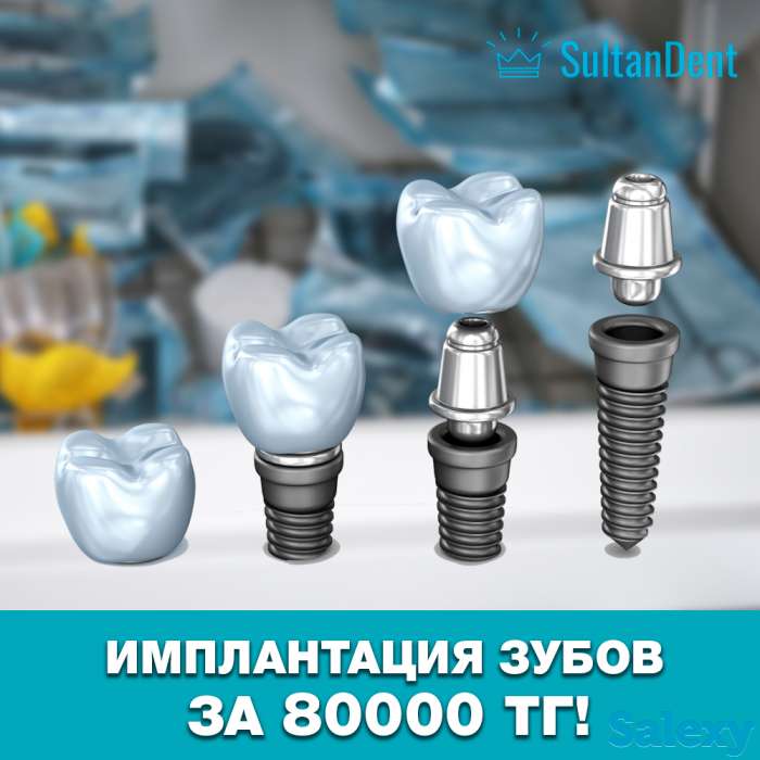 Имплантация зубов в Астане с гарантией!, фотография 1