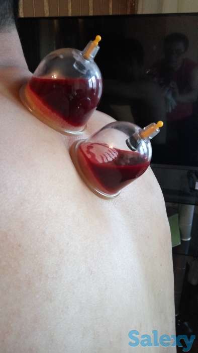 Хиджама, фотография 5