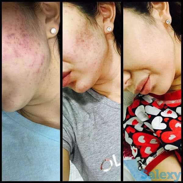 Здоровье и бизнес с продуктом правильного клеточного питания ELEV8 компании BEPIC, фотография 8