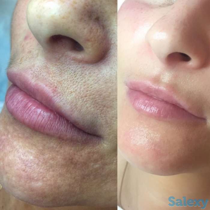 Инновация! BB glou! (тональный крем на год), фотография 2