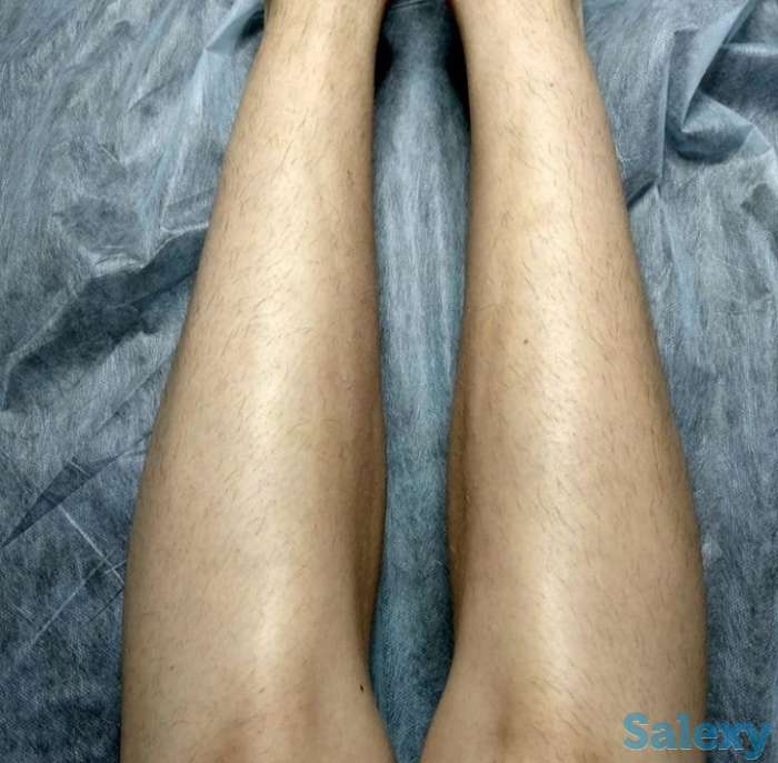 Шугаринг в Каскелене, фотография 1