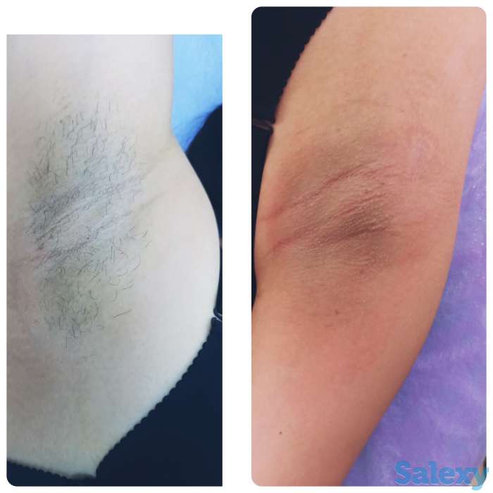 Мастер по шугарингу, фотография 1